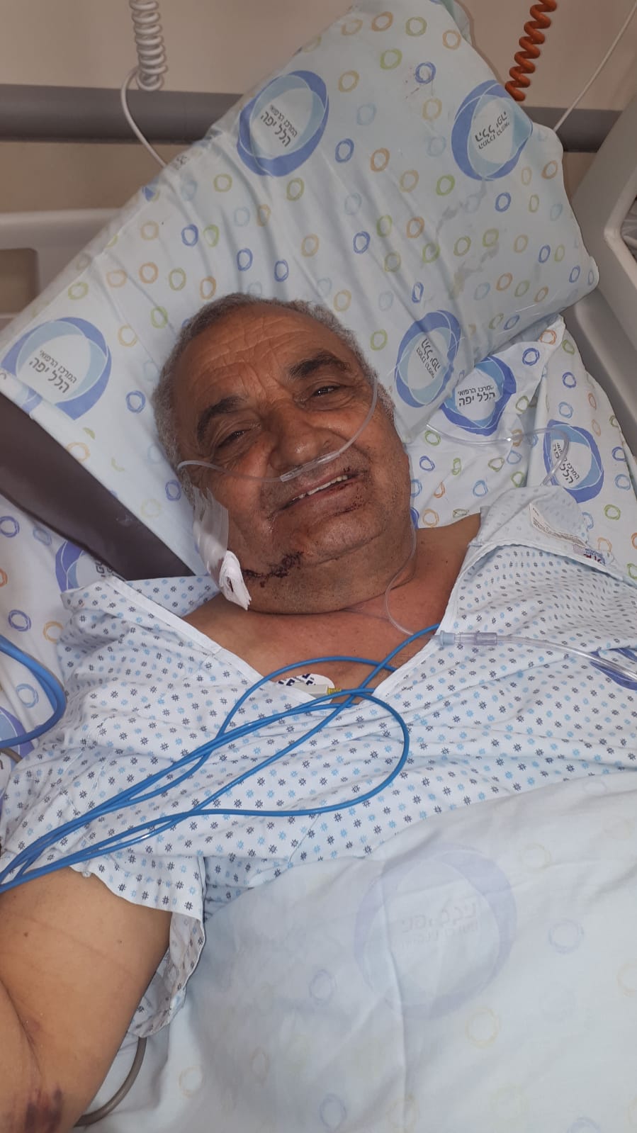 אלי גואטה לאחר הניתוח בבית החולים הילל יפה